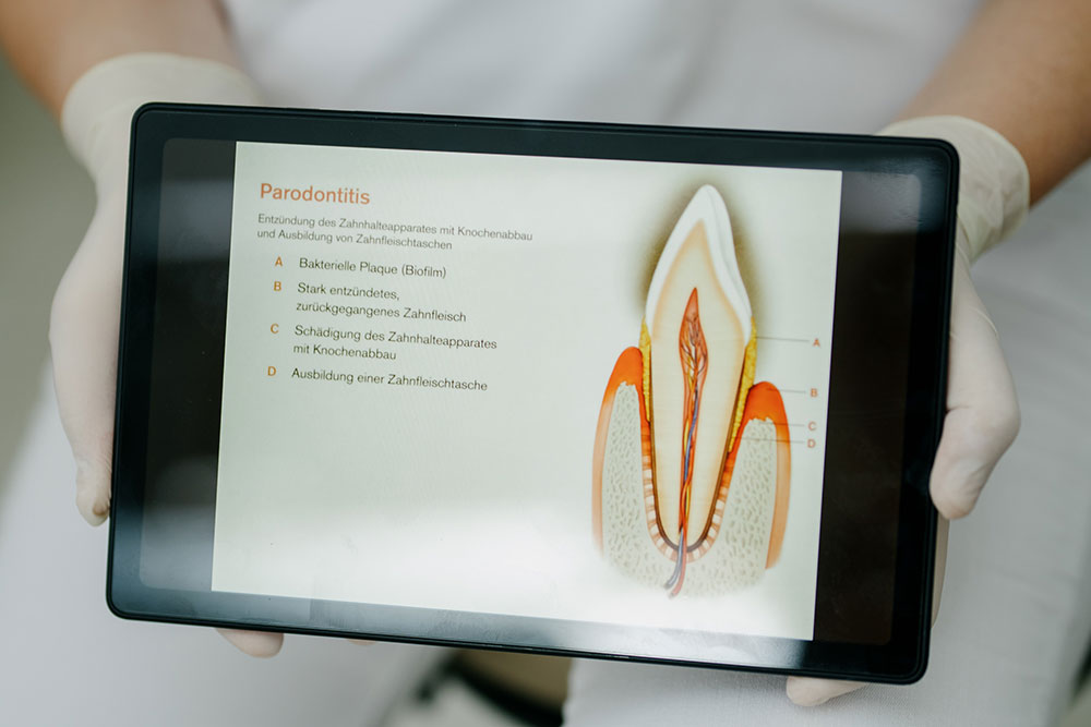 zahnarzt-holzkirchen- paro-v1